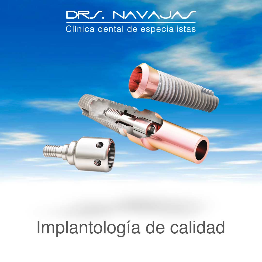 pepecanela.com
